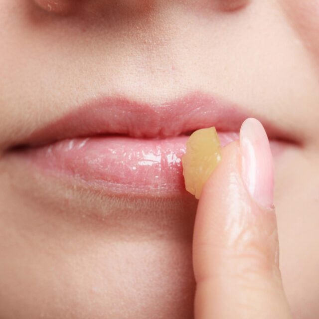 In Awe Blog: In Awe’s Kakadu Plum & Beeswax Skin Ointment for cracked and dry lips