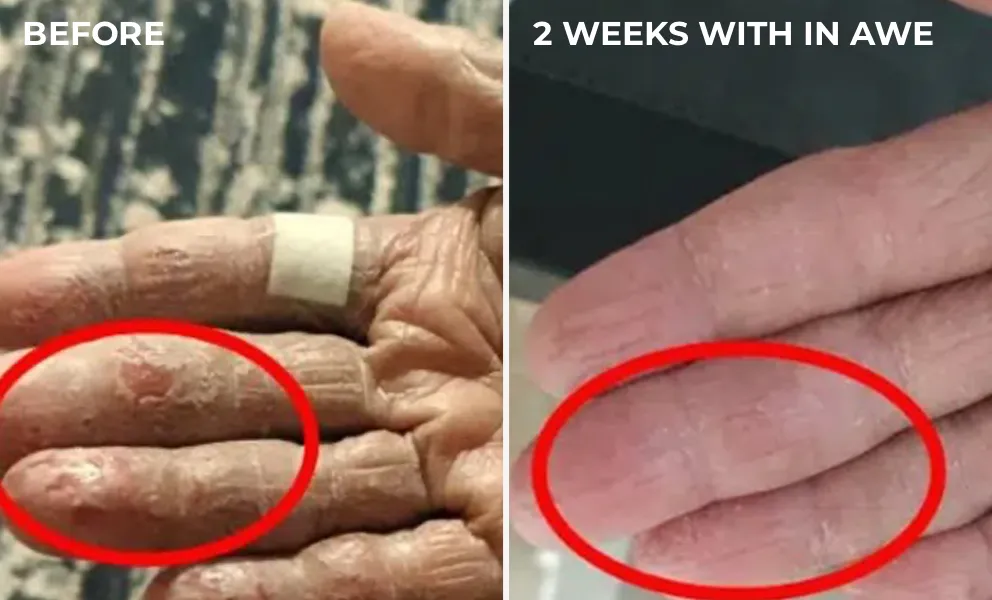 Yan's Mothers hands before and after using In Awe on her dry flakey hands