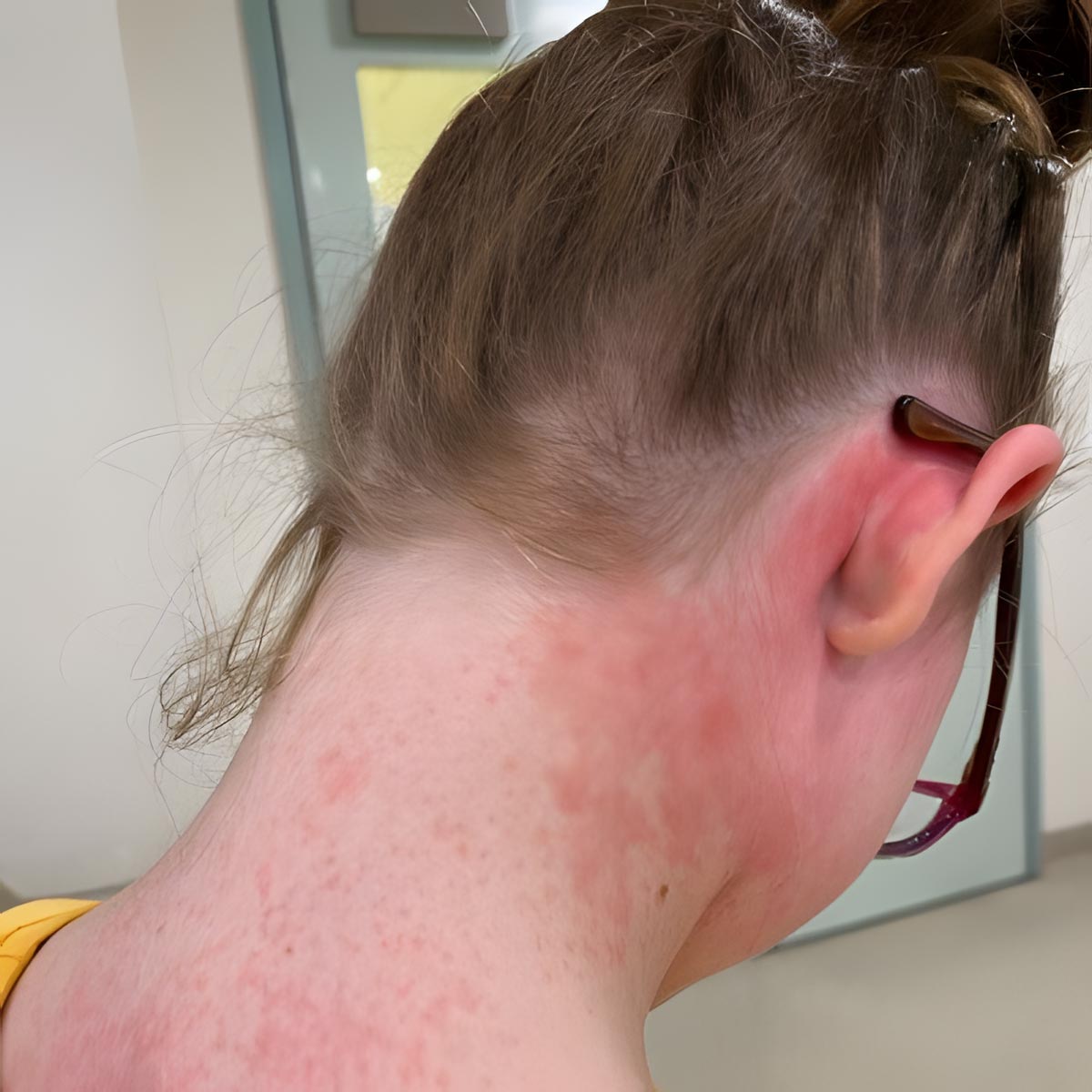 Success Story: Elly’s Story