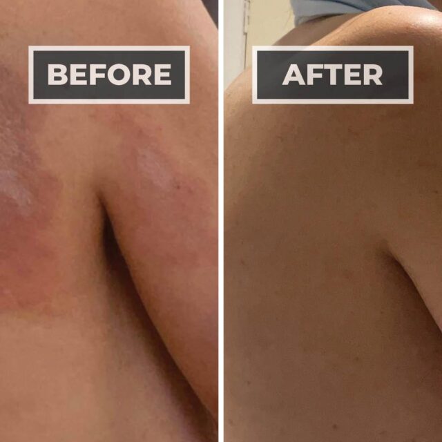 Success Story: Rachel’s Story