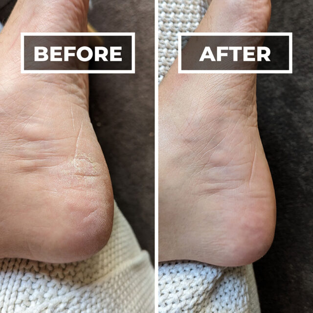 Success Story: Steve’s Story